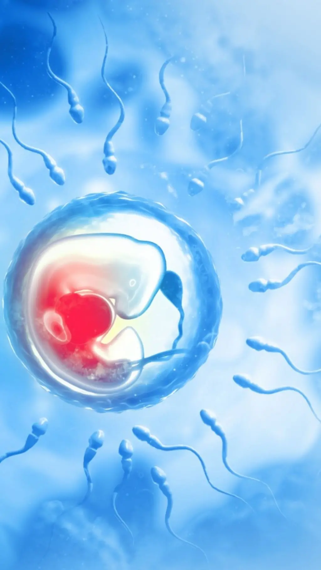 IVF