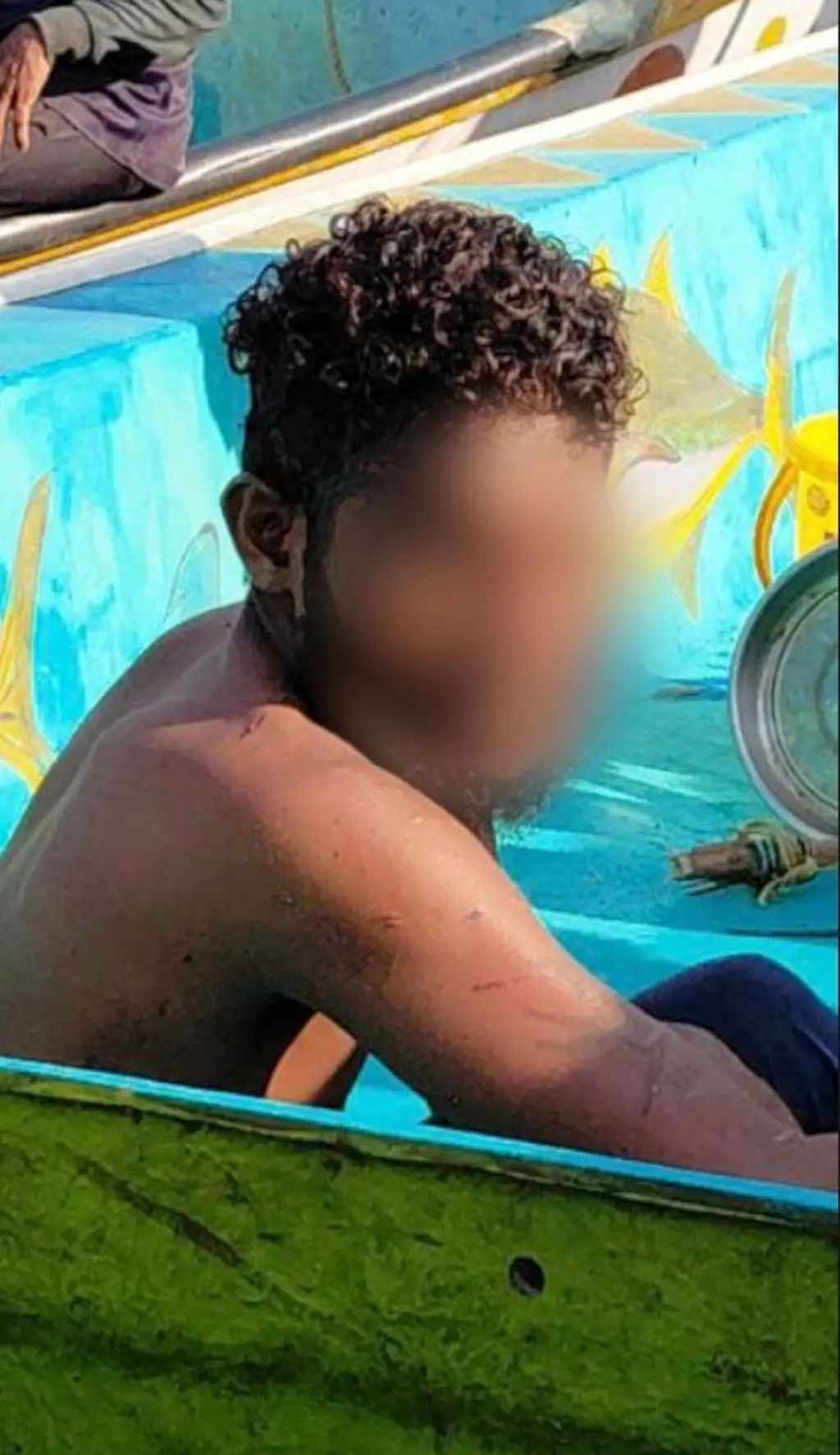 අතේ සිරීම් තුවාල සහිත පුද්ගලයෙකු කමිසයක් නොමැතිව බෝට්ටුවක වාඩි වී සිටින ආකාරය පෙනේ.