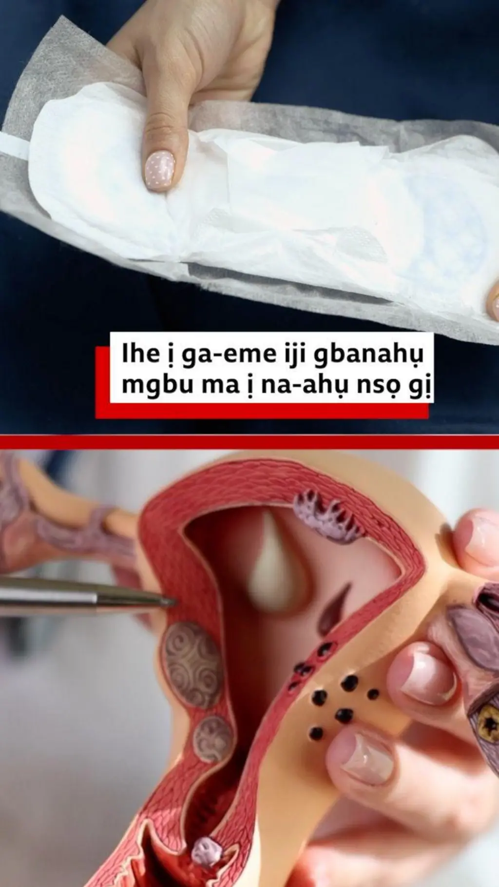 Ihe ị ga-eme iji gbanahụ mgbu ma ị na-ahụ nsọ gị