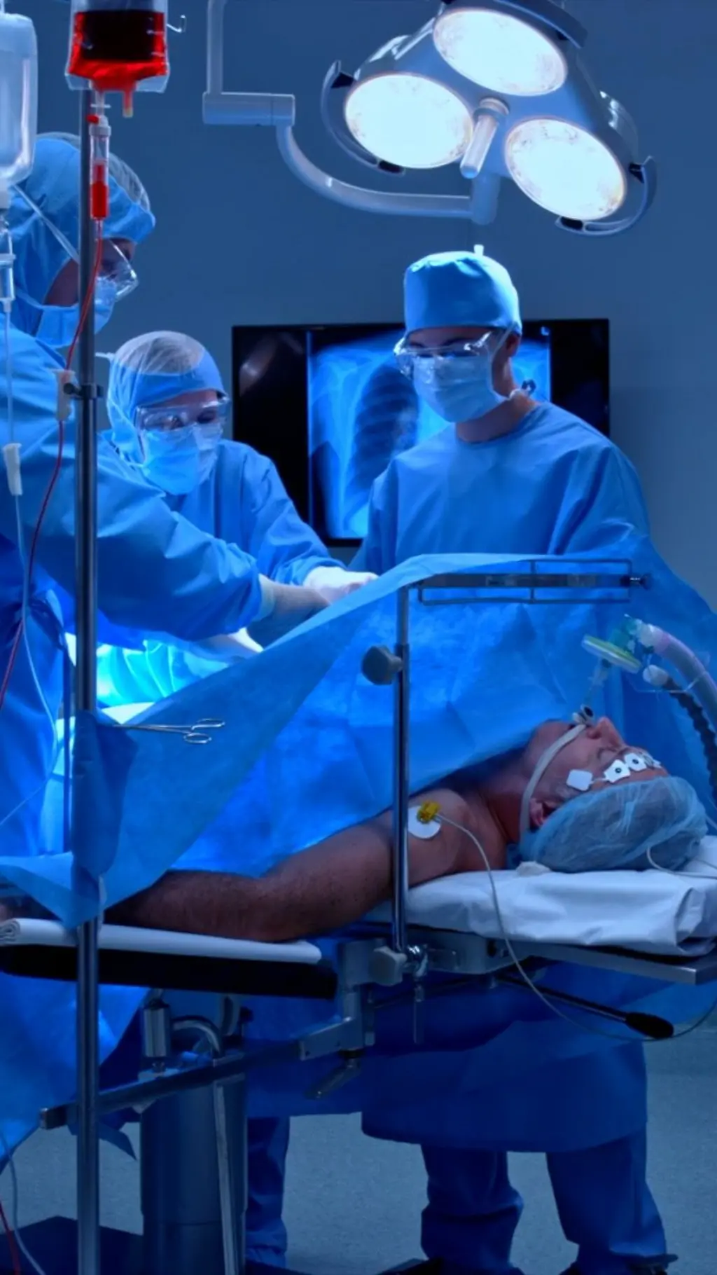 pacijent u operacionoj sali okruzen hirurzima