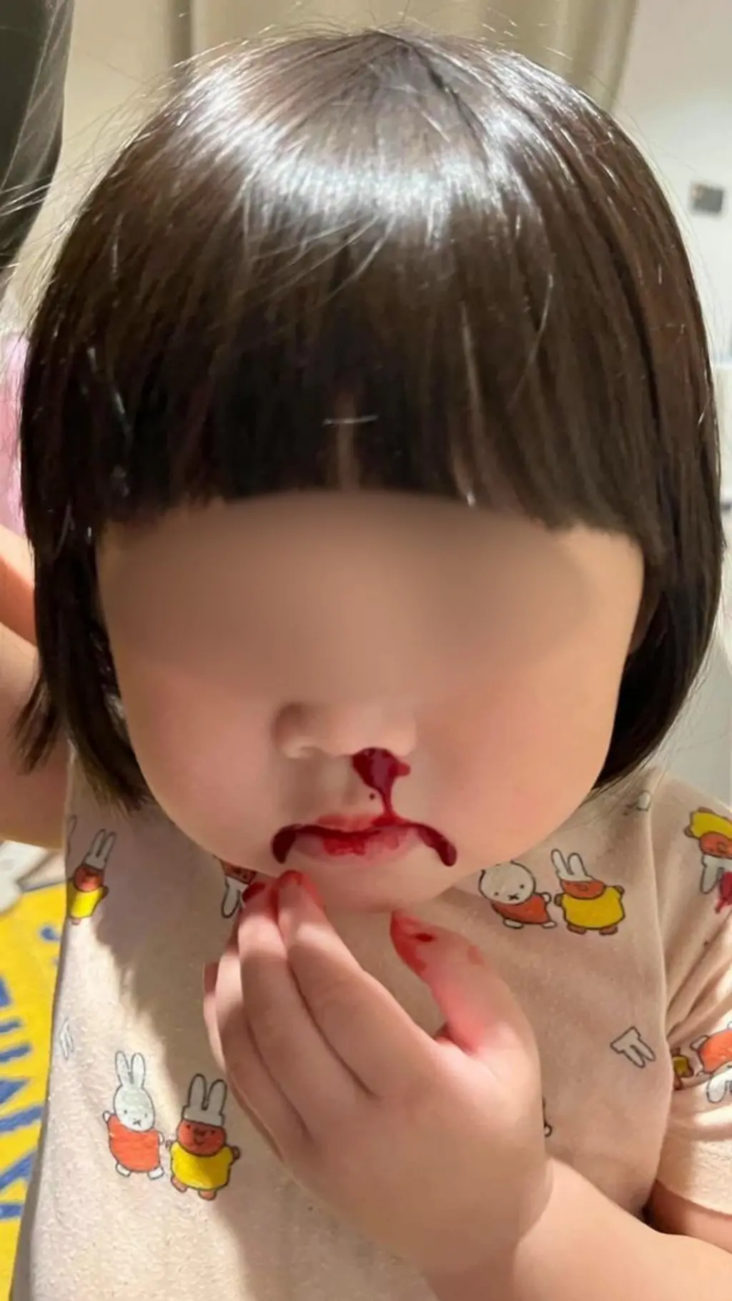 தாய்லாந்து: குழந்தைகள் மூக்கில் ரத்தம் வடிய காரணம் காற்று மாசுபாடா?