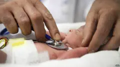 طفل مبتسر يخضع لكشف طبي