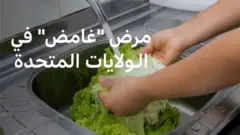 مرض السيكلوسبرا
