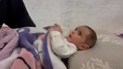 በዮርዳኖስ የልብ ቀዶ ጥገና ተደርጎላት ወደ ጋዛ እንድትመለሰ የተገደደችው የ7 ወሯ ኒቨን