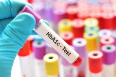 நீரிழிவு நோயாளிகளுக்கான HbA1C பரிசோதனை
