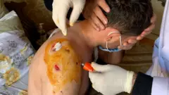 Ranjeni Azerbejdžanac