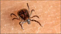 Shilinta nuugtaa dhiigga maqaarka dadka waxayna keentaa cudurka Lyme
