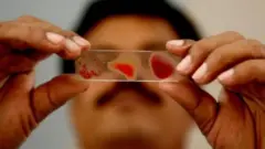 பாம்பே ஓ ரத்தப்பிரிவு