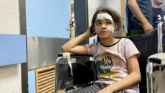  가자시티를 떠난 피난민들이 알시파 및 기타 병원에서 환자와 함께 대피 중이다 