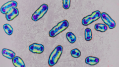 Imagem no microscópio mostra várias bactérias