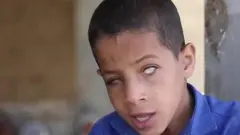 দৃষ্টি প্রতিবন্ধী আহমেদ