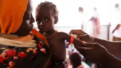 طفل سوداني يتم وزنه لفحص سوء التغذية عنده في مخيم للاجئين في تشاد