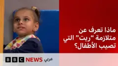 متلازمة ريت