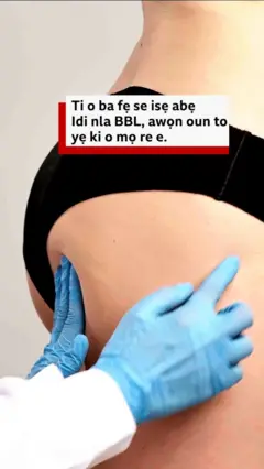 Ìdí tí dókítà ń fi ọwọ́ tẹ̀