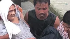 ဒဏ်ရာရသူတွေ ထဲမှာ အသက် ၉၃ နှစ်အရွယ် အမျိုးသားတစ်ဦးပါဝင်