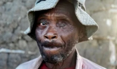 Umurimyi Tambala Jefra basize bamurokoye ijisho igihe yaterwa