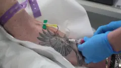 CANCER