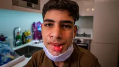صورة لماجد توضح إصابة فكه وشفتيه