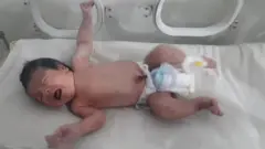 baby