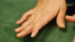 Синган бармоқлар