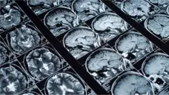 Cerveau humain