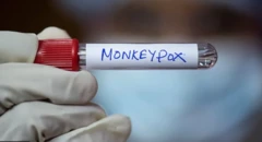 የዝንጀሮ ፈንጣጣ