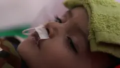 جنگ یمن: نظام درمانی در آستانه فروپاشی کامل
