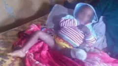 በከባድ መሣሪያ ጥቃት እግሩን ያጣው የሦስት ዓመቱ ዮናስ