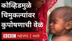 कुपोषण