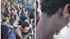 በእስር ላይ የሚገኙ ስደተኞች ለተለያዩ የጤና ችግር መጋለጣቸው እየተነገረ ነው