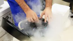 صورة لعملية تجميد البويضات