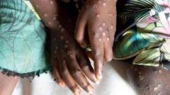 A six-year-old child suffering from suspected Mpox sits on a bed at Yalolia health center in Tshopo, Democratic Republic of Congo, October 3, 2022.