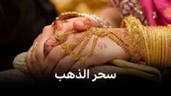  لماذا نجد الذهب ساحراً لهذه الدرجة؟