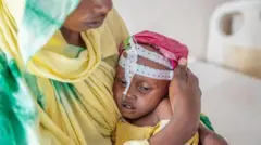 በድርቅ የተጎዳች ታዳጊ በእናቷ እቅፍ ውስጥ