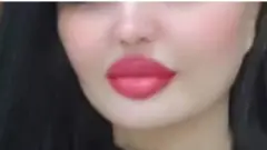 ۳۷ کلنه مژګان چې کابل کې یې د جراحۍ درې عملیاتونه ترسره کړي دي.