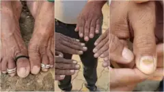 پہلے ناخن سخت ہوتے ہیں پھر ان پر پیلے دھبے پڑتے ہیں پھر ٹوٹنے لگتے ہیں