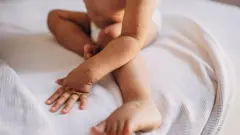 
Child with with hand foot and mouth disease 