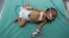 طفل من الأطفال الخدج في خروجه من غزة إلى مصر