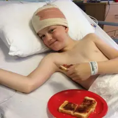 Un niño en una cama de hospital con la cabeza vendada. Junto a él, en la cama, hay un plato rojo y unas tostadas.