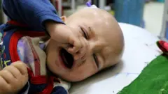 A child in receives treatment in the malnutrition department of Indira Gandhi Children Hospital in Kabul, Afghanistan, October 13 2021