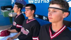 Jugadores de baseball usando las bandas Muse.