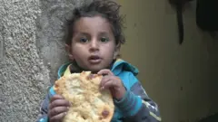 بحران غذا در یمن سازمان ملل می گوید پول و دسترسی نباشد مردم می‌میرند