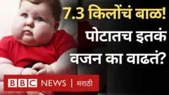 अबब! 7.3 किलो वजनी बाळाचा जन्म कसा झाला...
