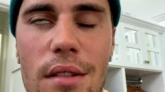 জাস্টিন বিবার তার চোখে পাতায় সমস্ন্যাযার কথা জানিয়েছেন।