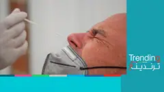 الكشف عن سلالة جديدة من فيروس كورونا لا يمكن اكتشافها بالمسحات