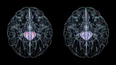 Ilustração da saúde da substância negra de dois cérebros