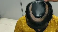 Gold smuglling