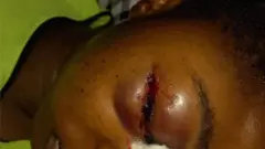 Sọpụrụchukwu sị na mgbọ ndị uweojii tụrụ ya n'isi