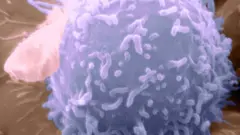 B細胞