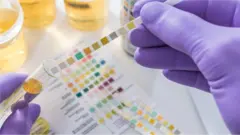 Un test d'urine a permis à Melissa Wairimu de diagnostiquer une infection des voies urinaires.